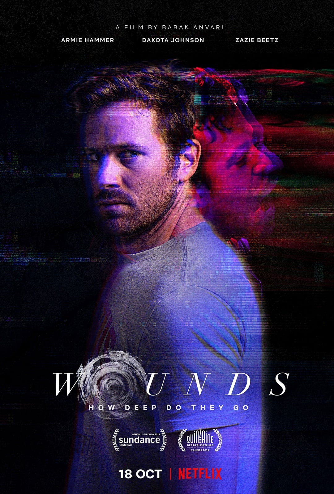 Wounds - Cover